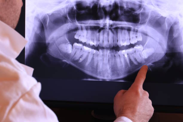 Best Urgent Care for Lost Fillings or Crowns in Canton, IL