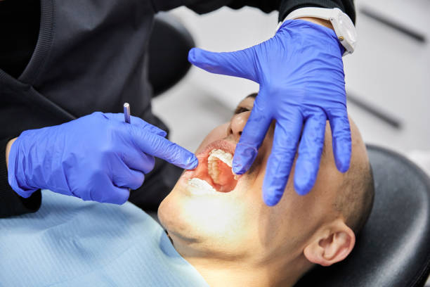 Best Emergency Root Canal Treatment in Canton, IL
