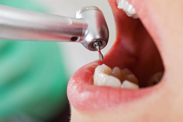 Best Cosmetic Emergency Dentistry in Canton, IL